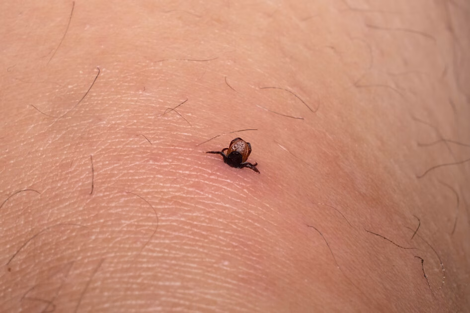 Erkių aktyvumas ilgėja: specialistai perspėja apie pavojingą erkinį encefalitą ir vakcinacijos svarbą